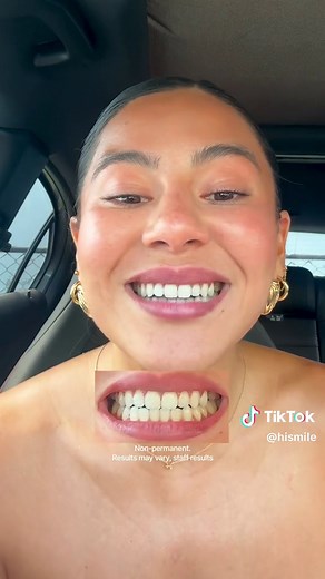 hismile on TikTok