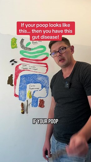 Your poop symptoms can help you know if you have IBS, BAM, Leaky gut, Crohn’s or Colitis!
