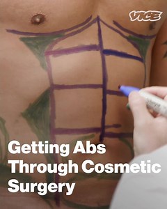 Although male plastic surgery has tripled in the last 20 years, few men discuss the alterations they seek. We followed two men getting cosmetic surgery: one getting liposuction on his abdominal area to get the six pack he always wanted and the other getting botox as a professional investment. | VICE