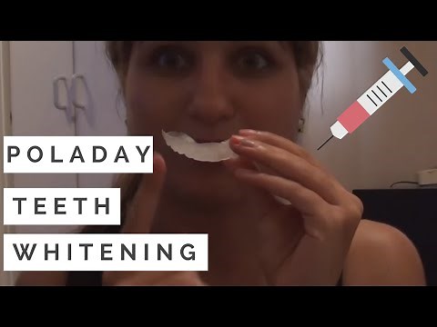 Poladay Tooth Whitening Review. 6% Hydrogen Peroxide Gel. Before & After Pictures