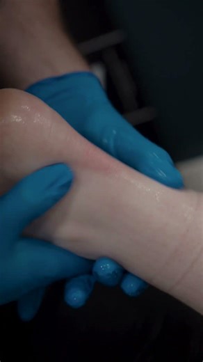 Achilles Pain? #shorts