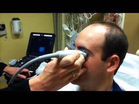 Ocular Ultrasound I