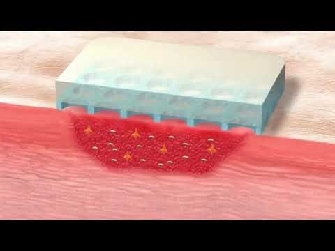 HydroTac Comfort 15×15 – Διαχείριση εξιδρώματος & υγρού περιβάλλοντος