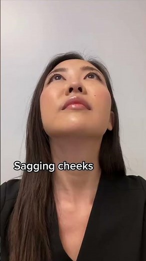 thread lift before and after #facelift #plasticsurgeon #threadlift