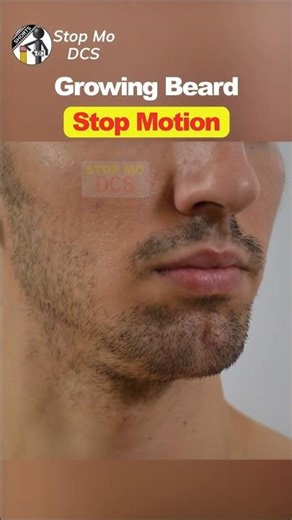 Beard Growth Timelapse