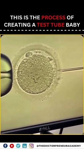 IVF: A Journey to Parenthood Through Advanced Fertility Solutions