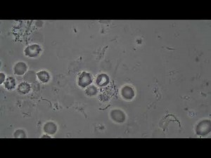 Spirochetes (Treponeme denticola) - Spirochaetes in phase contrast. Diseases of the mouth