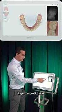 Have you used the powerful NIRI capture feature on your iTero intraoral scanner?