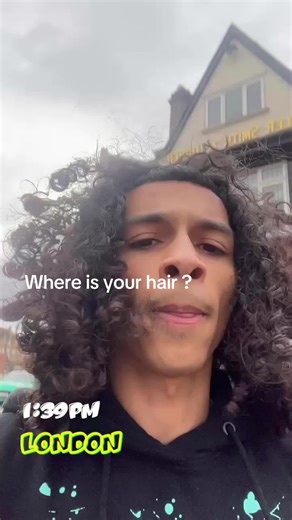 Finding My Lost Hair: A Journey