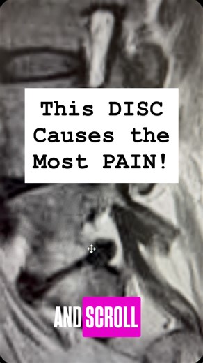 2.1K views · 250 reactions | The most common reason patients need...