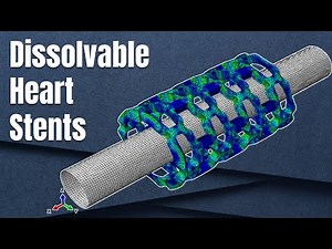 Numerical modelling of stents | Designing dissolvable stents