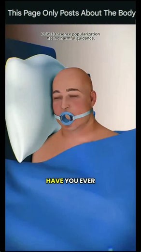 Explaining The Body on Instagram: "Ever felt that burning in your chest after eating — like your food’s trying to make a comeback? 😩 That’s acid reflux. And for some people, it’s not just an occasional thing… it’s every. single. day. Now imagine living like that — sleeping propped up on pillows, avoiding your favorite meals, and popping antacids like candy. Exhausting, right? That’s where TIF surgery (Transoral Incisionless Fundoplication) steps in. Here’s the cool part: no cuts. No scars. No b