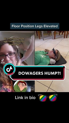 Get Rid of Your Back Hump! Part 2 - Practical Advice