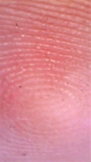 I put my own skin under the microscope! 🔬 This is crazy!