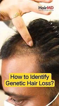 How To Identify Genetic Hair Loss Early! | Genetic Hair Loss Explained | HairMD Clinic, Pune