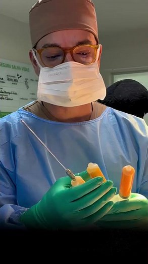 Fat grafting to the breasts for a beautiful and natural cleavage with lift without implants | Dr....