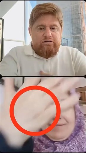 KAŞINMA, SEDEF, EGZAMA, VİTİLİGO, ÜRTİKER, ROSACEA, HERPES, SAÇ DÖKÜLMESİ, KEPEK… GERÇEK NEDENİ…