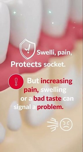 🦷 Seeing a White Blood Clot After a Tooth Extraction?