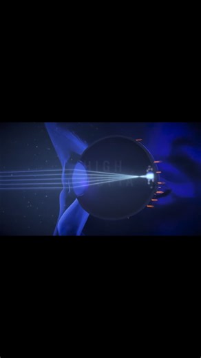 Eyecon Optometry Kuantan on Instagram: "Stellest Lens ✅ Melambatkan kenaikan rabun sehingga 67% Terbukti secara klinikal melalui kajian jangka panjang. ✅ Lindungi kesihatan mata jangka panjang Kurangkan risiko rabun teruk & komplikasi mata bila dewasa. ✅ Teknologi H.A.L.T yang pintar & selamat Bekerja secara “senyap” untuk kawal pertumbuhan mata anak. ✅ Anak selesa, cepat adapt Tiada rasa pening, silau atau gangguan penglihatan. ✅ Nampak seperti cermin mata biasa Tiada dot kelihatan, tak nampak