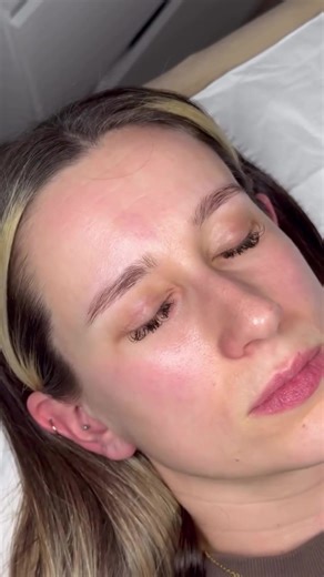 Come and get my eyebrows done with me 🩷 I have been wanting this done for YEARS but I was so scared it was going to be painful and “what if I didn’t like them?” Well, I am kicking myself for not getting this done sooner. Just LOOK at the result 👀 Shan put me totally at ease, listened to exactly what I wanted and we had some giggles along the way! Such a lovely experience. For all you folk that said it hurts so bad and that you weren’t happy with the result… you’re going to the wrong person! Sh