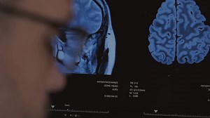 AI in Healthcare: Revolutionizing Diagnosis, Treatment, and Patient Care