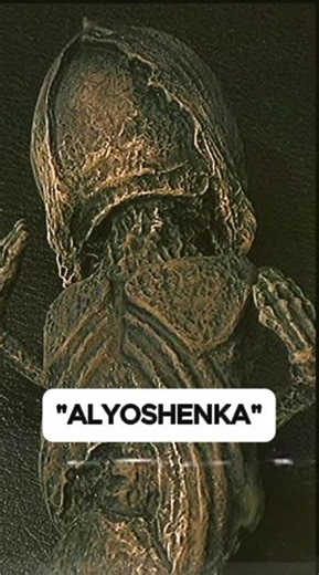 The Kyshtym Dwarf: Russia's Most Terrifying Alien Mystery