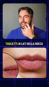 A volte interpretiamo piccoli fastidi come casualità, quando invece sono veri e propri segnali di carenze nutrizionali specifiche. Hai presente quei fastidiosi taglietti ai lati della bocca? Spesso non sono solo colpa del freddo, ma possono indicare una carenza di Vitamina B12 o di Zinco, elementi chiave per la riparazione dei tessuti e il sostegno immunitario. E che dire di quegli spasmi involontari alla palpebra o ai muscoli delle gambe? In molti casi è il tuo corpo che reclama Magnesio. Quest