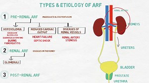 Acute kidney Failure Made Easy- Part 1 2 | My Health Tips | Facebook