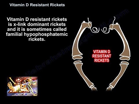 Vitamin D Resistant Rickets - Everything You Need To Know - Dr. Nabil Ebraheim • Video • MEDtube.net