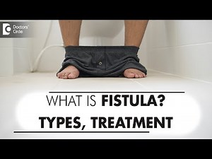 FISTULA ANIMATION | Fistula Types | Treatment: Surgery & Laser-Dr. Rajasekhar M R | Doctors' Circle