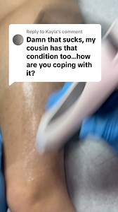 149K views · 2.8K reactions | Waxing with tendinitis has its good days and bad days but I’ll tell you what when you love what you do you make it work! Roll-on wax by Black Coral Wax  #foryoupagereels #fypシ゚ #estheticianlife #legwax #satisfying #viral #tendinitis #dontgiveup #makeithappen | Waxing Queen | Facebook