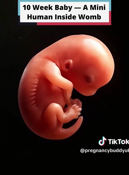 Descubre cómo luce tu bebé a las 10 semanas en el útero