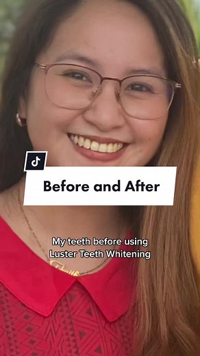 Transform Your Smile with Luster Instant Whitening Toothpaste