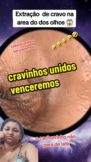 Extração de Cravo Profissional: Limpeza e Satisfação