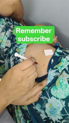 IM injection #treanding #shortsbeta #youtubeshorts