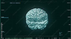 Digital Visualisation Of Brain Localises Brain Tumor During Analysis. Technologically Advanced Software Checks For Brain Tumor. Brain Tumor Diagnosed Via Medical Examination. User Interface Stock Video