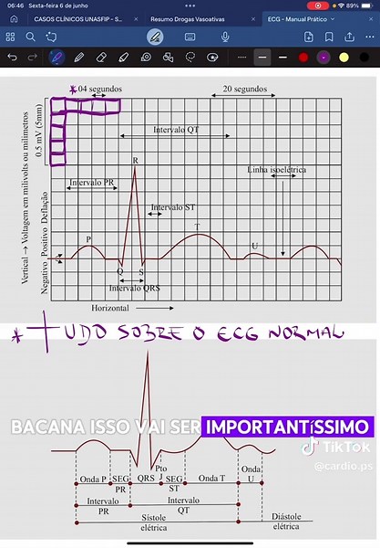 Curso Completo de ECG por R$97 - Aprenda Facilmente