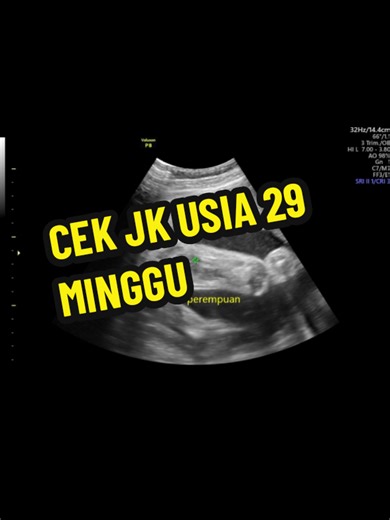 USG KEHAMILAN JANIN USIA 29 MINGGU | TRIMESTER 3 Biaya Pasang IUD di Purwokerto Tempat Pasang KB IUD di Purwokerto Program Hamil Purwokerto Klinik Promil di Purwokerto Biaya Konsultasi Program Hamil di Purwokerto Dokter Promil Terbaik di Purwokerto USG kehamilan banyumas USG 4D Purwokerto murah Tempat USG Terdekat di Purwokerto Jadwal Dokter USG Kandungan Purwokerto Biaya USG 2D/4D di Purwokerto USG Promil dan Konsultasi Program Hamil Purwokerto USG Transvaginal Dokter Spesialis Purwokerto USG K