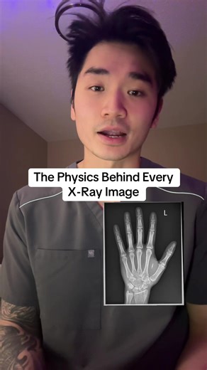 The physics behind every x ray image #TikTokCreatorSearchInsightsIncentive #greenscreensticker
