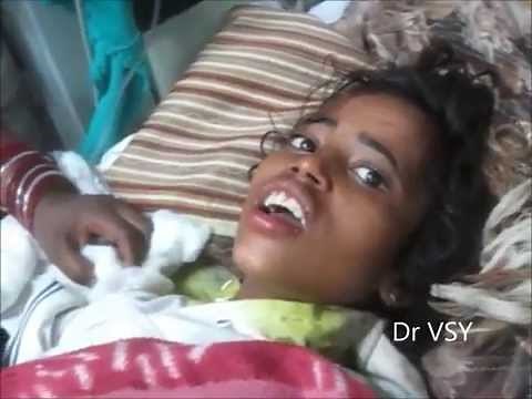 Aerophobia In Rabies