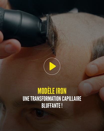 Regardez la transformation incroyable de Thomas grâce à la pose d'un complément capillaire Hairskeen. Le changement est saisissant, le résultat naturel. Voyez par vous-même. #hairskeen #complementcapillaire #iron #menstoupee #hairloss #nonsurgicalhairreplacement #menshairtoupee #chutedecheveux #calvitiesolution #calvitie | Hairskeen