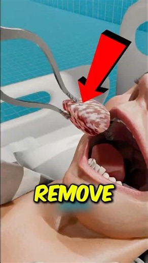 HOW Is This Possible? Losing Your Tongue Affects More Than Just Talking 👅🗣️