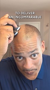FlexSeries Pro is a head shaver designed for bald men to get a smooth head shave in 90 seconds.  Shaving your head with a razor is a hassle, and it’s impossible to avoid cuts & irritation. And clippers don’t shave close enough… The easiest way to get a smooth head shave without nicks, bumps, or irritation is with the FlexSeries®. You can get the FlexSeries® Kit for 60% OFF + 4 Free Gifts, plus a 30-day risk-free trial for a limited time. | Freebird | Facebook