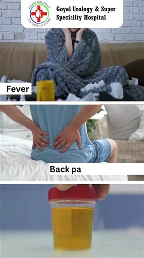 Kidney Pain vs Back Pain | Know the Difference#backpain #kidneydisease#urology#goyalurologyhospitals