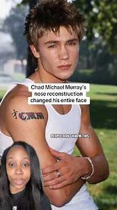 Chad Michael Murray’s nose reconstruction changed his entire look