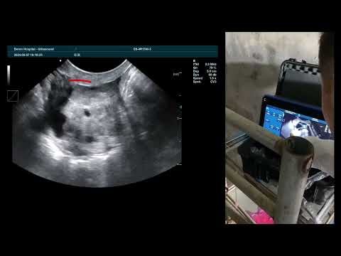 Efficient Bovine OPU System | Collect Oocytes with Precision – BXL-DB20