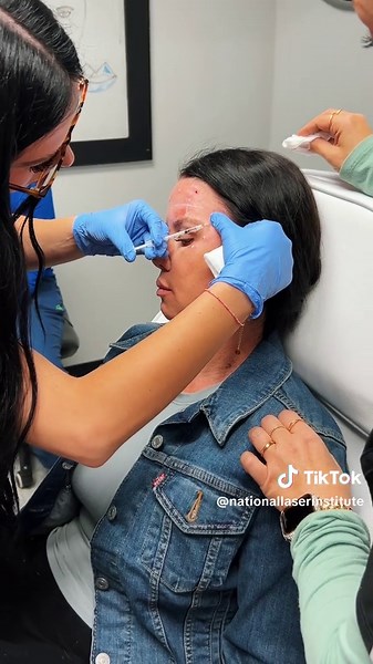 Are you a healthcare professional eager to specialize in cosmetic injections? Our top-tier training program at National Laser Institute is designed to help you master the art of Botox, dermal fillers, and other advanced injectable treatments. 🌟🧬 Immerse yourself in hands-on training with the latest techniques, guided by industry experts. Our comprehensive courses ensure you gain the practical skills and confidence needed to deliver exceptional results. Whether you’re a nurse, physician, or ano