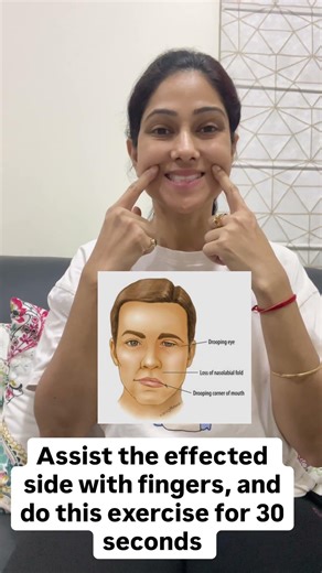 Bell,s palsy exercises #exerciseroutine#apkiphysio
