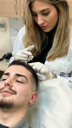 💉 PRP για τα μαλλιά!