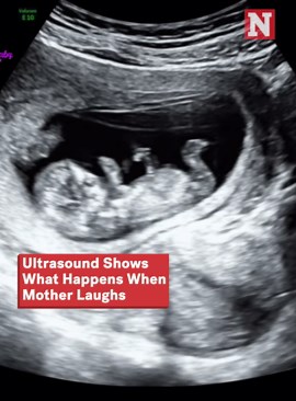 Ultrasound Shows What Happens To A Baby When Mother Laughs